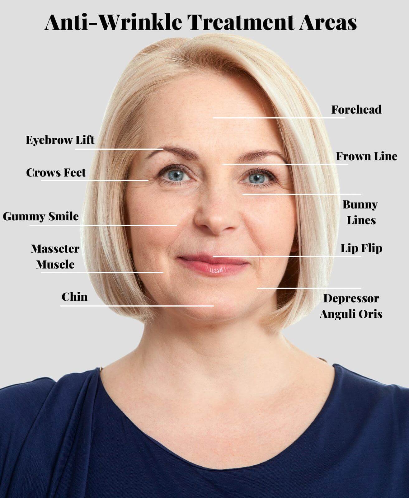 Anti-Wrinkle treatment areas