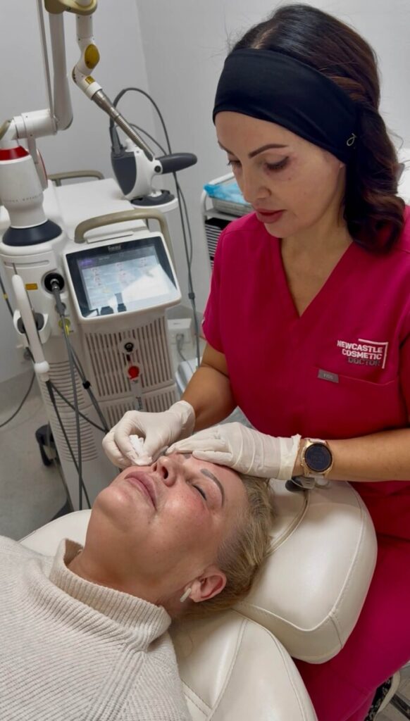 Sharon Leayr performing laser therapy on face